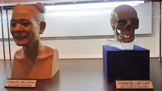 Orang Jōmon — Skull of Jomon people with artificially mutilated teeth.