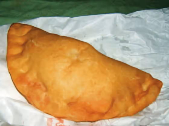 Panzerotti — Calzone Fritto Pugliese, versione con pomodoro, mozzarella, prosciutto e oliva (Apulian fried calzone this version with tomato, mozzarella, bacon and an olive)
