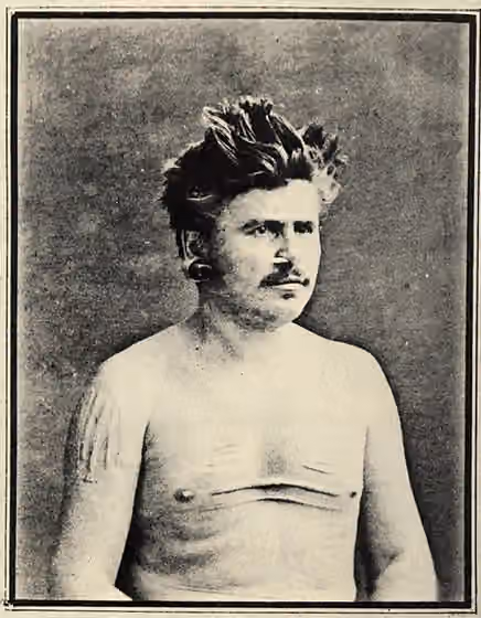 Uutaalnganu — Narcisse Pelletier photographié à son retour à Nantes en 1876.